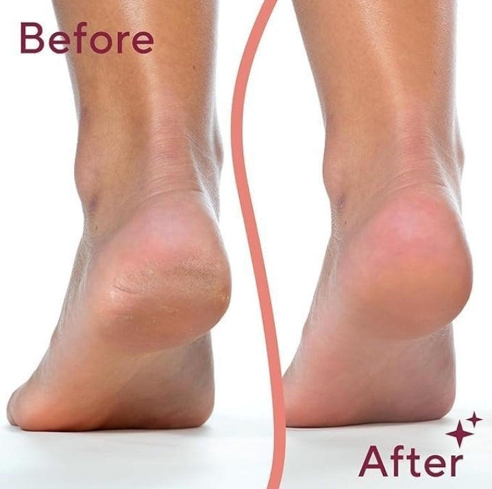 Electric Pedicure Tool