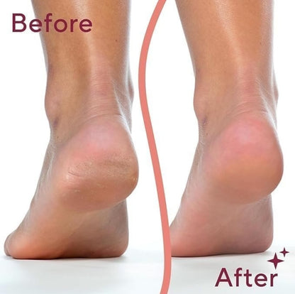 Electric Pedicure Tool