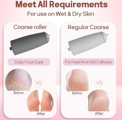 Electric Pedicure Tool